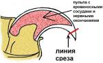 1371128036_kak-strich-kogti-koshke_02.jpg 1371128036_kak-strich-kogti-koshke_02.jpg